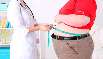La obesidad es una enfermedad como cualquier otra. No es una elección sino una patología