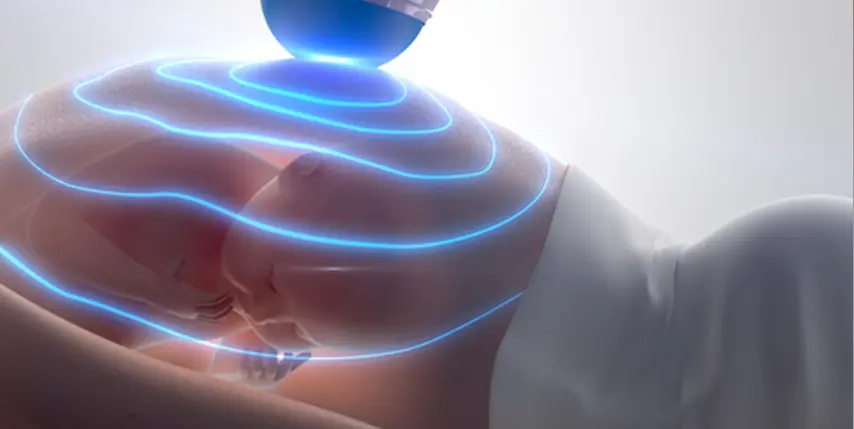 La ecografía en el tercer trimestre de embarazo La ecografía en el tercer trimestre de embarazo