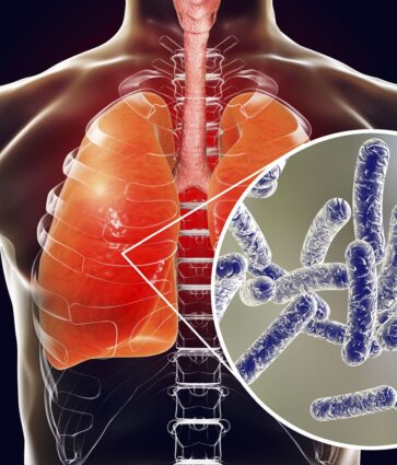 Rentokil Initial: Nuevas medidas para proteger la salud pública: así es el nuevo Real Decreto para la prevención y el control de la legionelosis