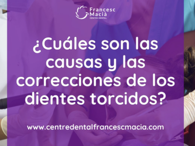 El Centre Dental Francesc Macià analiza las causas y las correcciones de los dientes torcidos