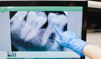 «Cada vez hay más evidencia de que la enfermedad periodontal, una inflamación crónica de las encías, puede estar relacionada con un mayor riesgo de sufrir infartos o accidentes cardiovasculares», doctor Carlos Mederos