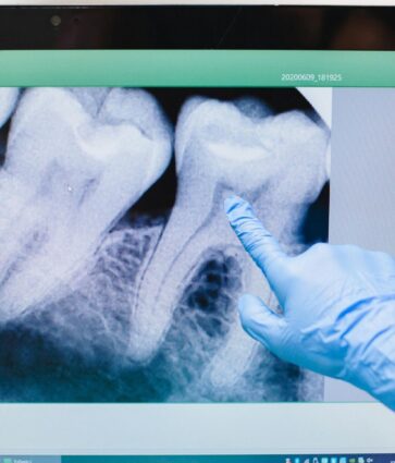 «Cada vez hay más evidencia de que la enfermedad periodontal, una inflamación crónica de las encías, puede estar relacionada con un mayor riesgo de sufrir infartos o accidentes cardiovasculares», doctor Carlos Mederos