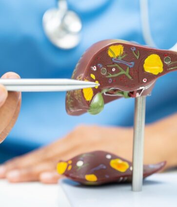 Dr. Alfredo Yoldi, endocrinólogo de Policlínica Gipuzkoa: Una nueva esperanza para el tratamiento del hígado graso