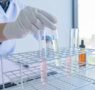 «El cribado de portadores genéticos ayuda a prevenir la transmisión de enfermedades hereditarias»