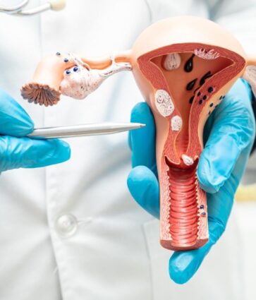 Dra. Blanca Fernández, ginecóloga de Policlínica Gipuzkoa: «Con una buena prevención y tratamiento del VPH, podemos prevenir el cáncer de cuello de útero»