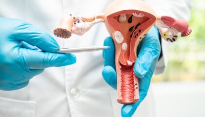 Dra. Blanca Fernández, ginecóloga de Policlínica Gipuzkoa: «Con una buena prevención y tratamiento del VPH, podemos prevenir el cáncer de cuello de útero»