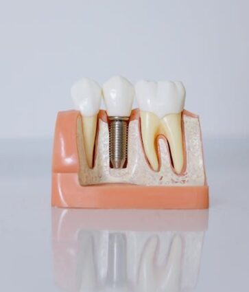 Dr. Javier Ortiz de Urbina: «El éxito de un implante dental depende en gran medida de la experiencia del profesional»