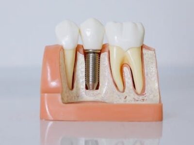 Dr. Javier Ortiz de Urbina: «El éxito de un implante dental depende en gran medida de la experiencia del profesional»