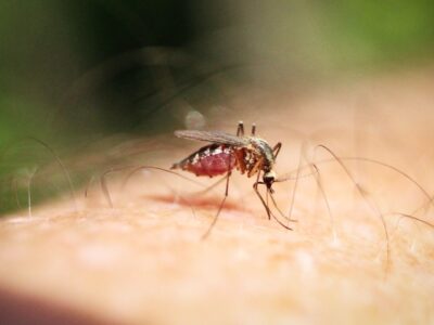 Ingrid Hiltun, dermatóloga de Policlínica Gipuzkoa: «Se recomienda limpiar la zona de la picadura con agua y jabón, aplicar frío y evitar el rascado»