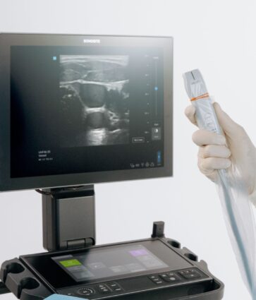 Sonosite LX introduce la ultra-alta frecuencia en POCUS con el primer y único transductor de 46 MHz