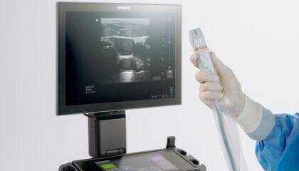 Sonosite LX introduce la ultra-alta frecuencia en POCUS con el primer y único transductor de 46 MHz