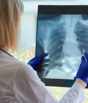 Dr. Aitor Asensi, neumológo de Policlínica Gipuzkoa: «Dejar de fumar es la medida más importante para frenar la evolución de la EPOC»