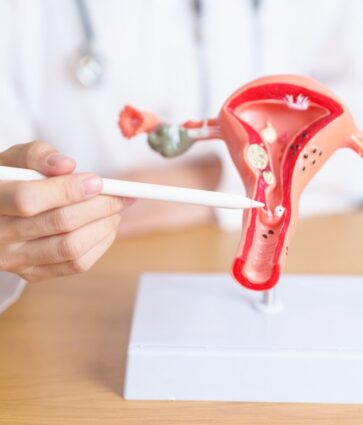 Dr. Juan Céspedes, ginecólogo de Policlínica Gipuzkoa: «La endometriosis deteriora la calidad de vida, es difícil de diagnosticar y muchas mujeres la ocultan por vergüenza o por creer que es normal»