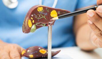 Dr. Juan Arenas, especialista en Aparato Digestivo de Policlínica Gipuzkoa: «La pérdida de peso es la clave para mejorar el hígado graso y el síndrome metabólico»