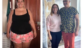 Manga Gastrica en Turquía: el Dr.Volkan Arayıcı ofrece consejos para elegir la clínica adecuada para cada paciente